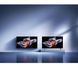 Телевізор Xiaomi TV S Pro Mini LED 65 2026 1468729 фото 7